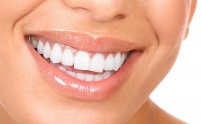 De ce evita unii oameni implantul dentar